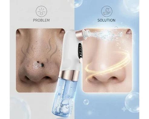 Skincare routine for blackheads and clogged pores