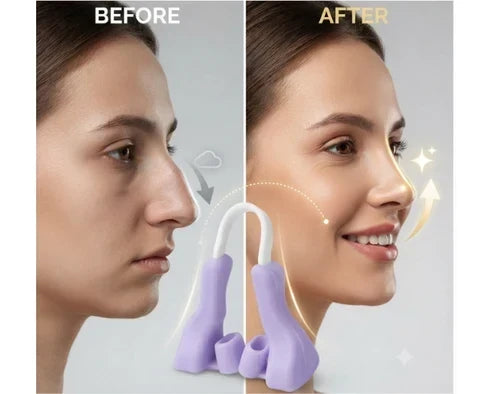 Silicone Nose Beauty Device for facial contouring