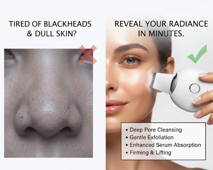 Palm Sonic Facial Cleansing Brush