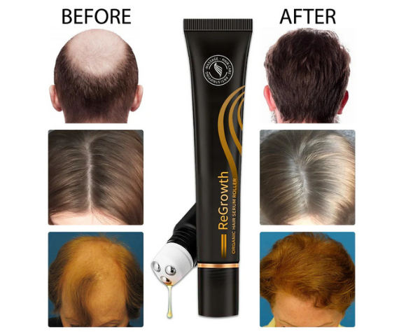 Hair Growth Essential Oil 20ml | Nourishing Scalp & Hair Care Serum UAE