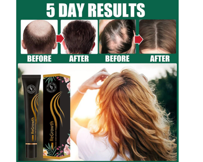 Hair Growth Essential Oil 20ml | Nourishing Scalp & Hair Care Serum UAE