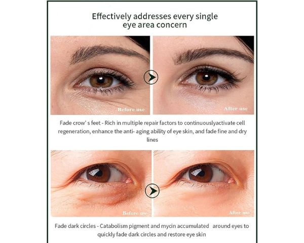Time Eraser Eye Essence Oil - Under Eye Nourish Refresh Serum 10ml Pro+