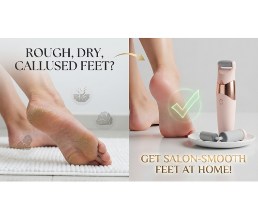 Electric foot callus remover