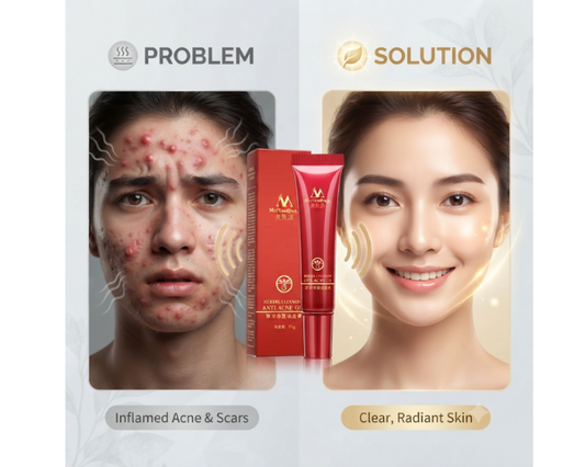 MeiYanQiong Herbal Acne Treatment Face Cream 15ml for targeted facial skincare.
