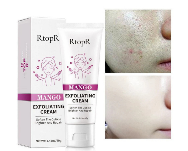 Gentle peeling gel