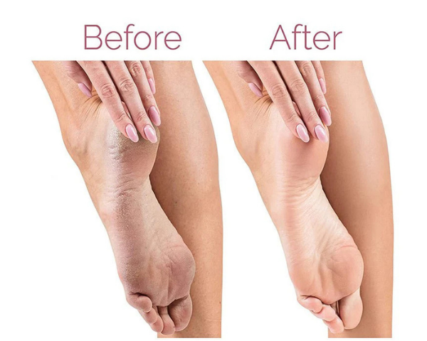 Rechargeable foot file